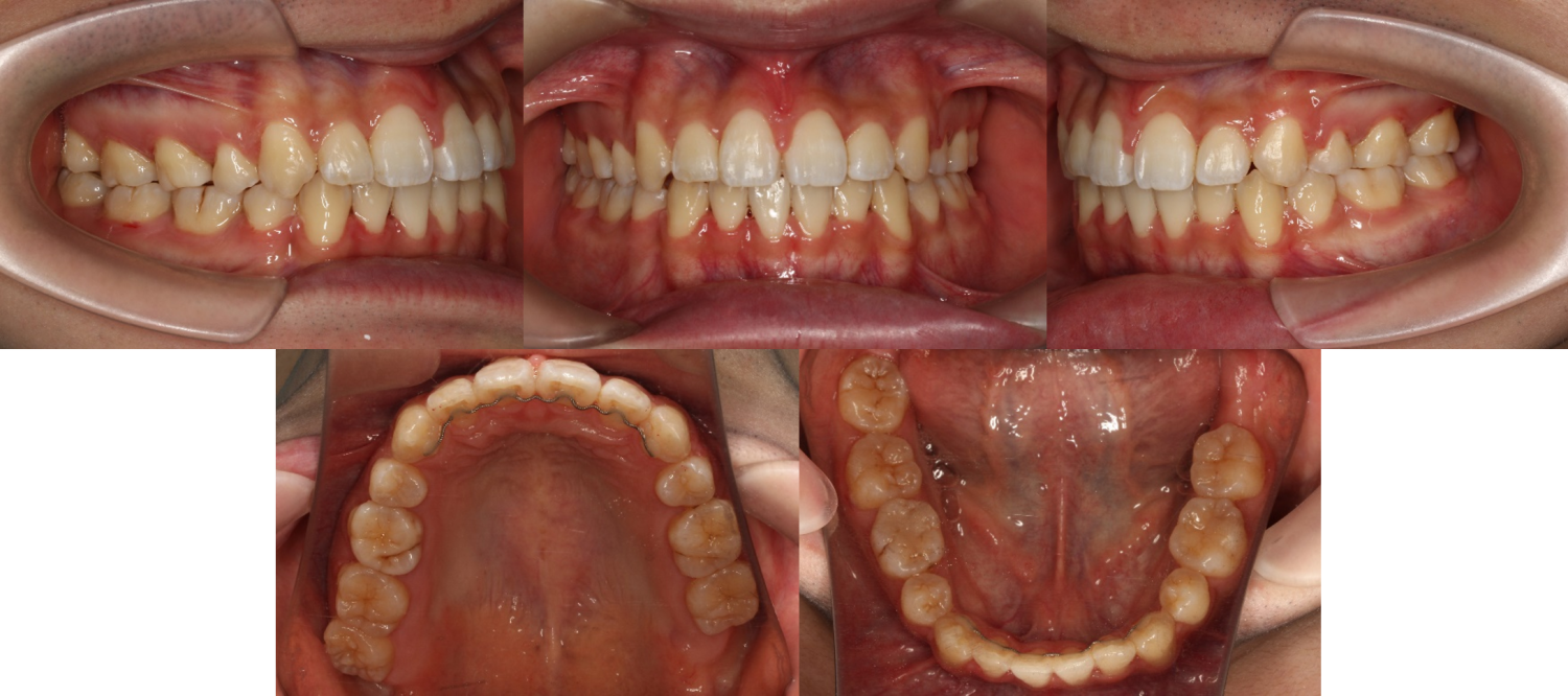 蒲田あさみ矯正歯科