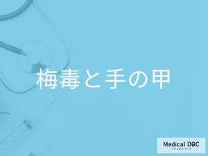 「梅毒」を発症すると「手の甲」にどんな症状が現れるかご存知ですか？【医師監修】