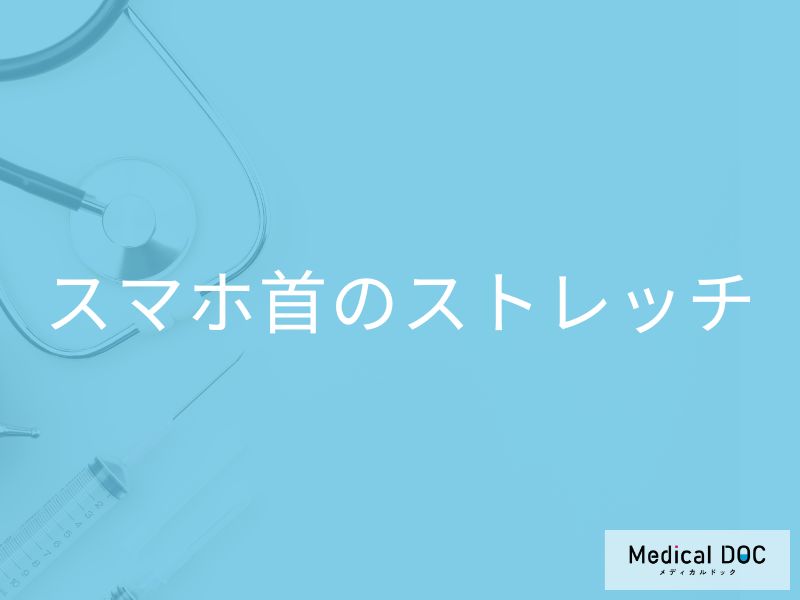 「スマホ首を改善するストレッチ」はご存知ですか？ストレッチを行う際に注意点も解説！