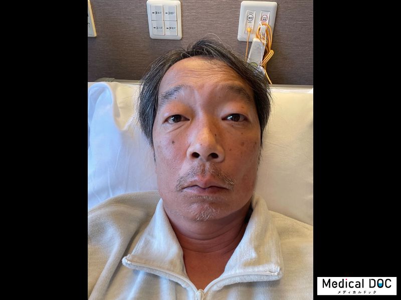 見栄晴「咽頭がんステージ4」からの生還。命を懸けた100日間の壮絶闘病とは