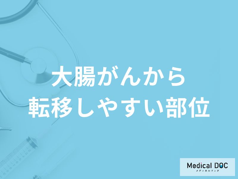 「大腸がんから転移しやすい場所」はご存知ですか？転移後の症状も医師が解説！