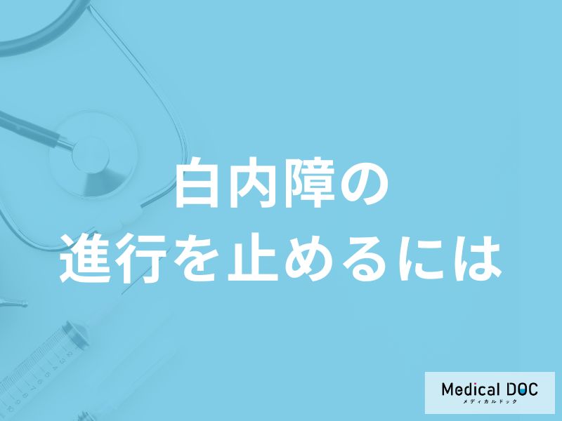「白内障の進行を止める」にはどうすべき？進行度別の症状や食事面のポイントも解説！