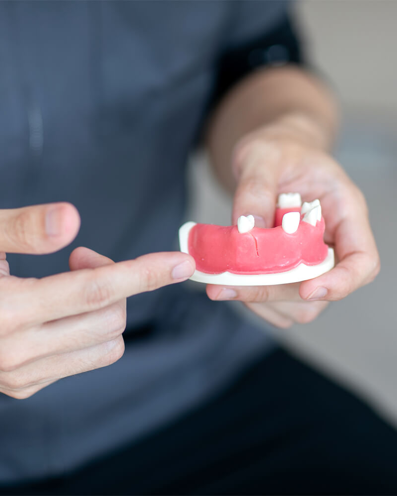 放置したままだとリスクしかない「親知らず」