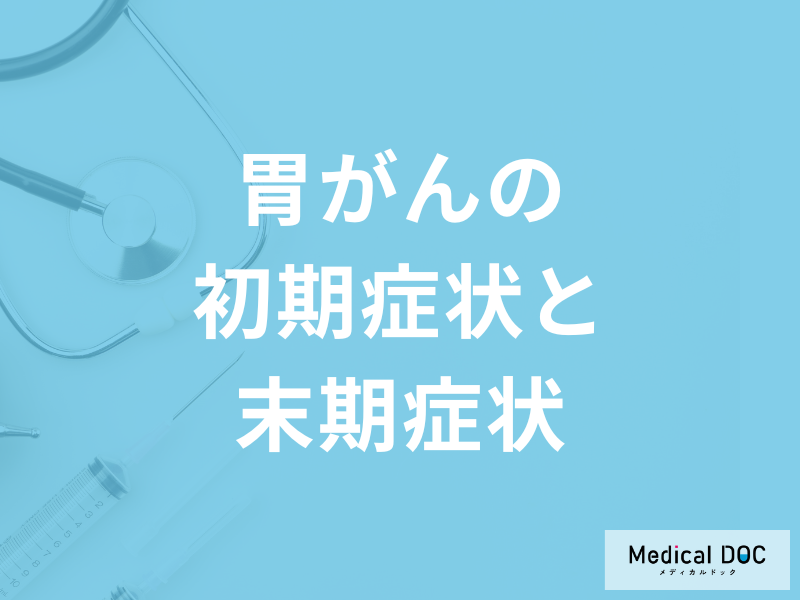 「胃がんの初期症状と末期症状」はご存じですか？医師が徹底解説！