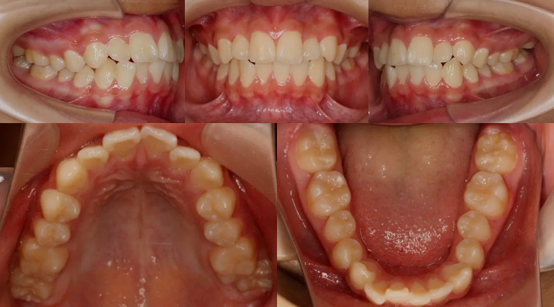 蒲田あさみ矯正歯科