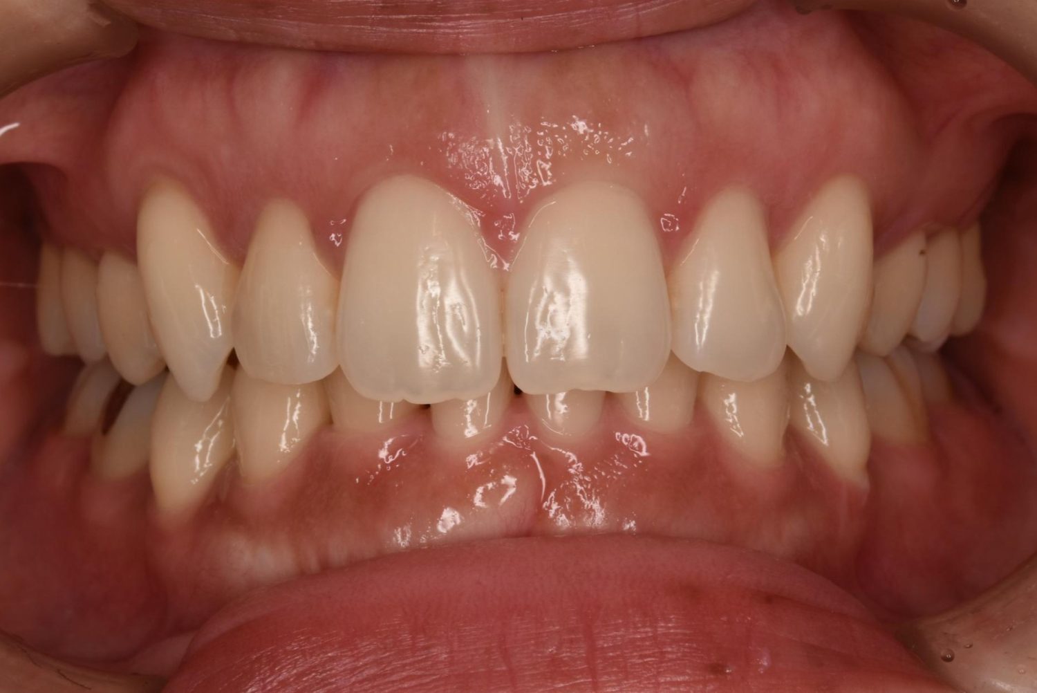 シャングリラデンタル横浜歯科矯正歯科