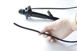 大腸カメラは、大腸がん予防のために何歳から受けるべきかご存じですか？ 医師が解説