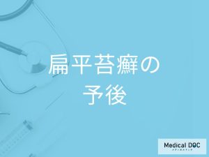 「扁平苔癬（かゆみを伴う発疹）」は”がん化する可能性”がある？再発率も医師が解説！