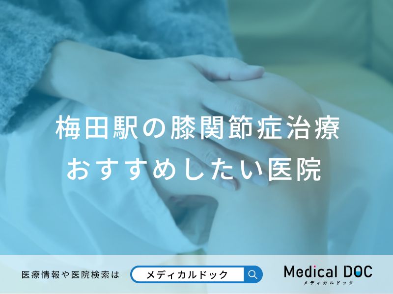 梅田駅の膝関節症治療 おすすめしたい医院