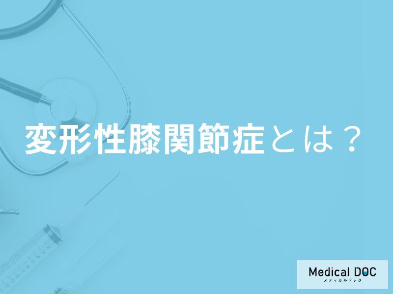 正座や階段がつらい… 女性に多い「変形性膝関節症」恐ろしい進行とは【医師解説】