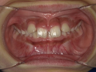 チャイルドしかハウス