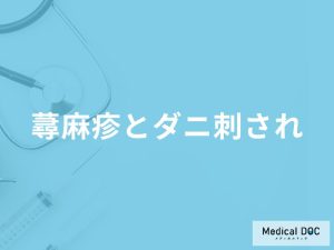 「蕁麻疹とダニ刺され」の見分け方はご存知ですか？症状の違いも解説！【医師監修】