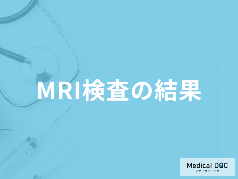 「MRI検査の結果」で精密検査になる基準はご存知ですか？医師が徹底解説！