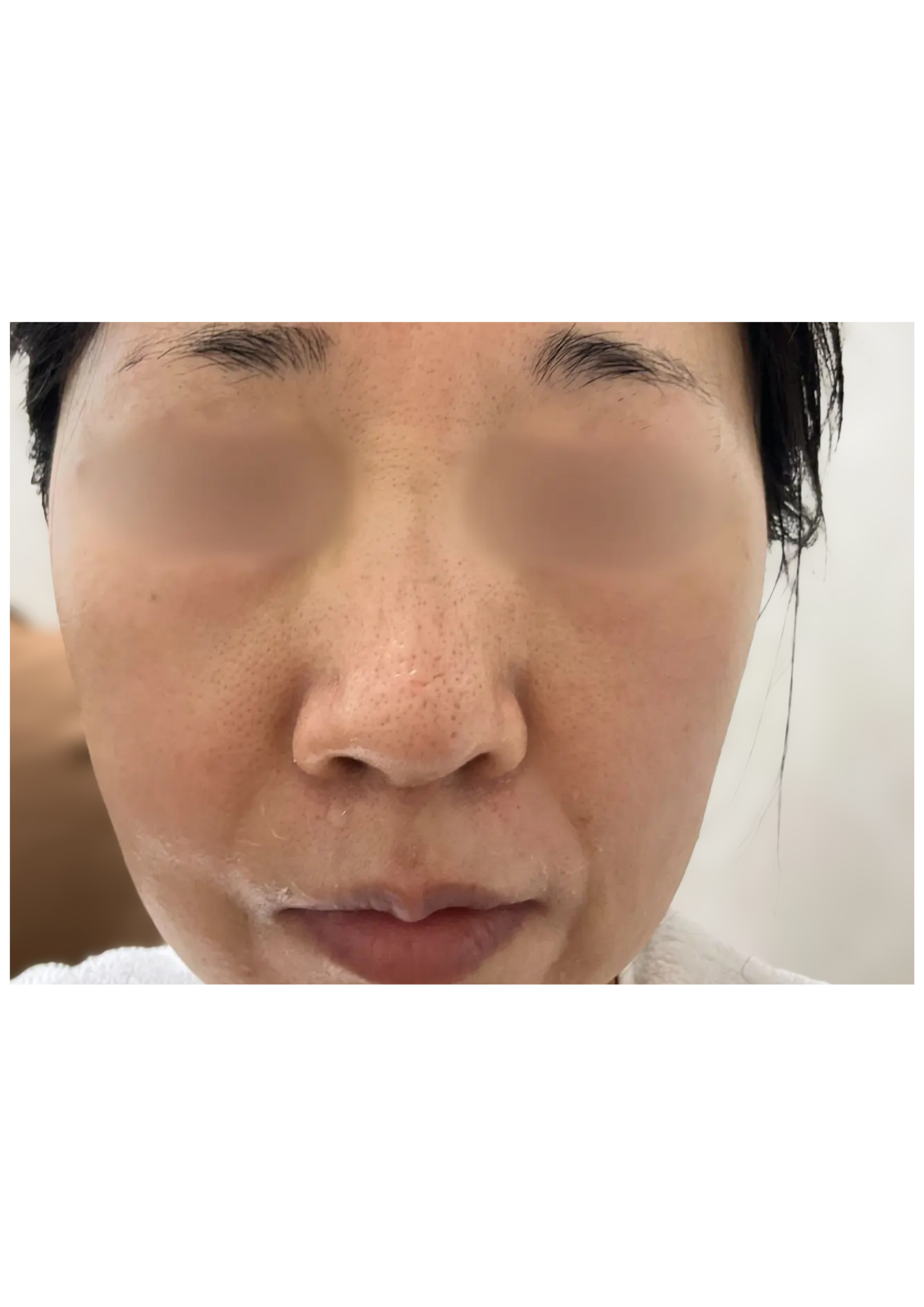 牧田医院・ピコスポット取り放題＋ガウディスキンセラピューティック②・after・正面