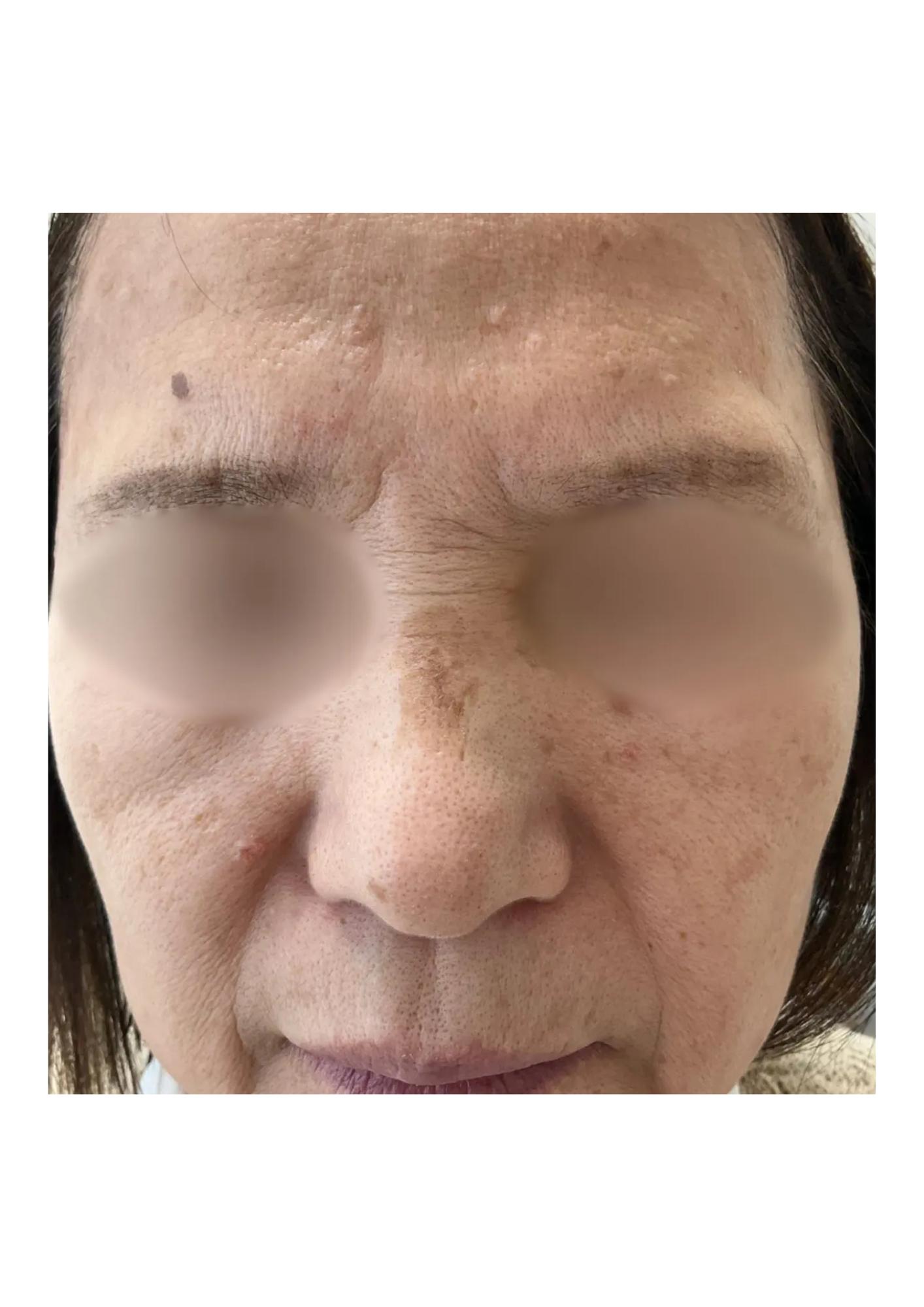 牧田医院・ピコスポット＋マルチパス・before・正面