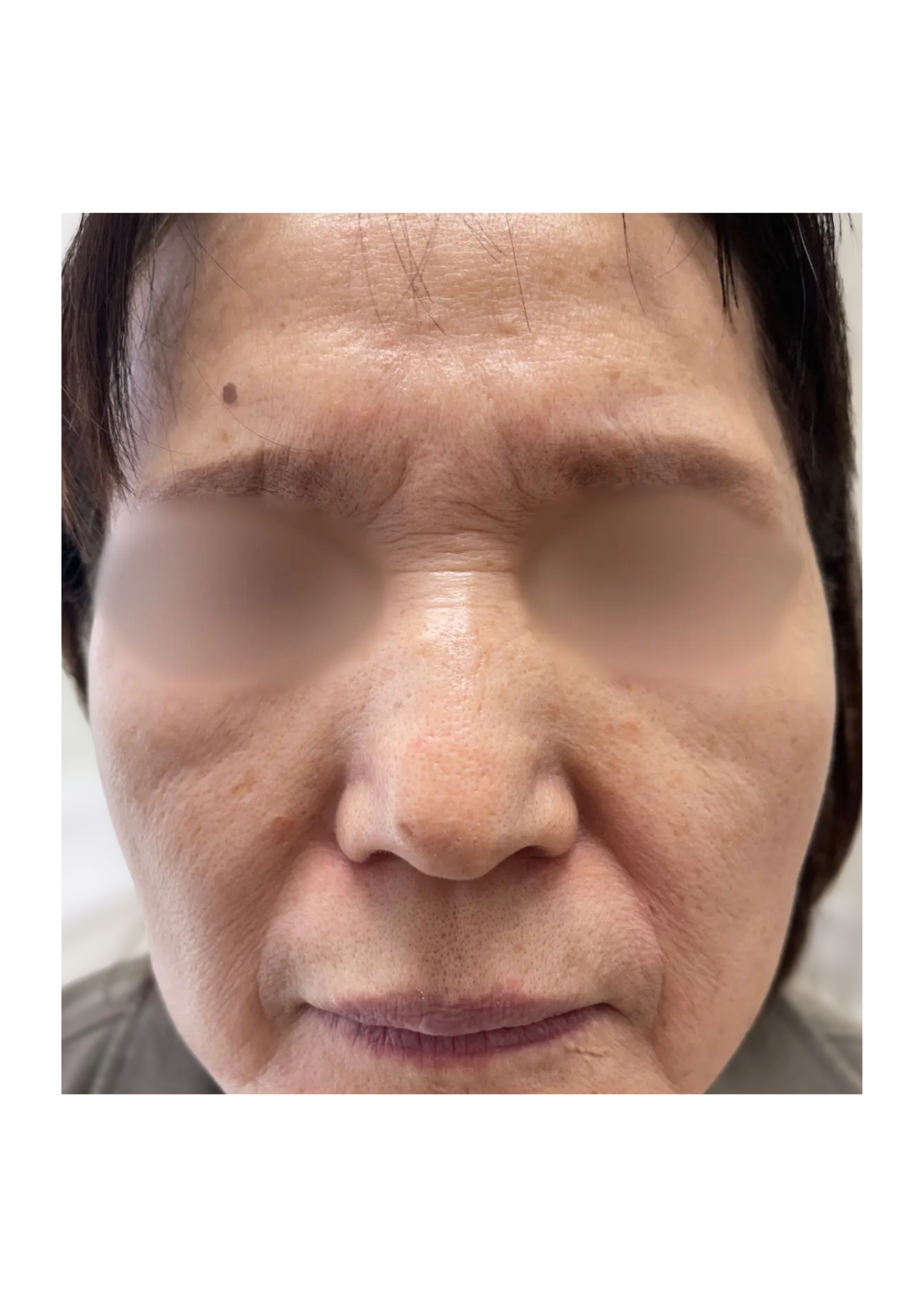 牧田医院・ピコスポット＋マルチパス・After・正面