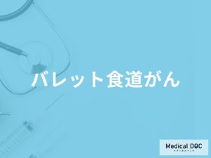 「バレット食道がん」の症状やなりやすい人の特徴はご存知ですか？医師が解説！
