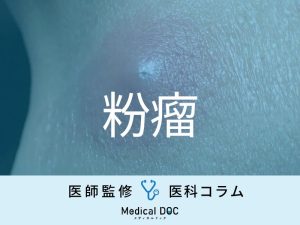 「粉瘤」は放置するとどうなるかご存じですか？ 悪性化することは？【医師解説】