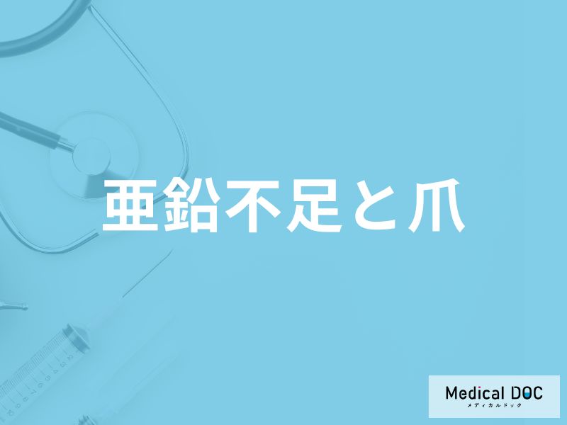 「亜鉛が不足」すると現れる「爪の5つの症状」はご存知ですか？【医師監修】