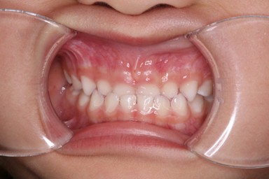 チャイルドしかハウス