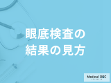 「眼底検査の結果の見方」はご存じですか？緑内障を含む発見できる病気も医師が解説！