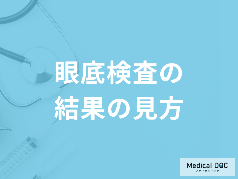 「眼底検査の結果の見方」はご存じですか？緑内障を含む発見できる病気も医師が解説！