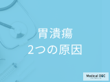 非公開: “ストレスで胃に穴が開く”は少数派 「胃潰瘍」の2大原因はご存じですか? 医師が解説!