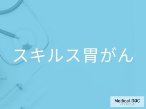 スキルス胃がん