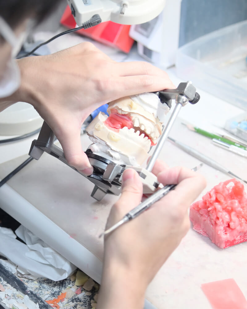 技工士常駐による、オーダーメイド性を突き詰めたセラミック治療