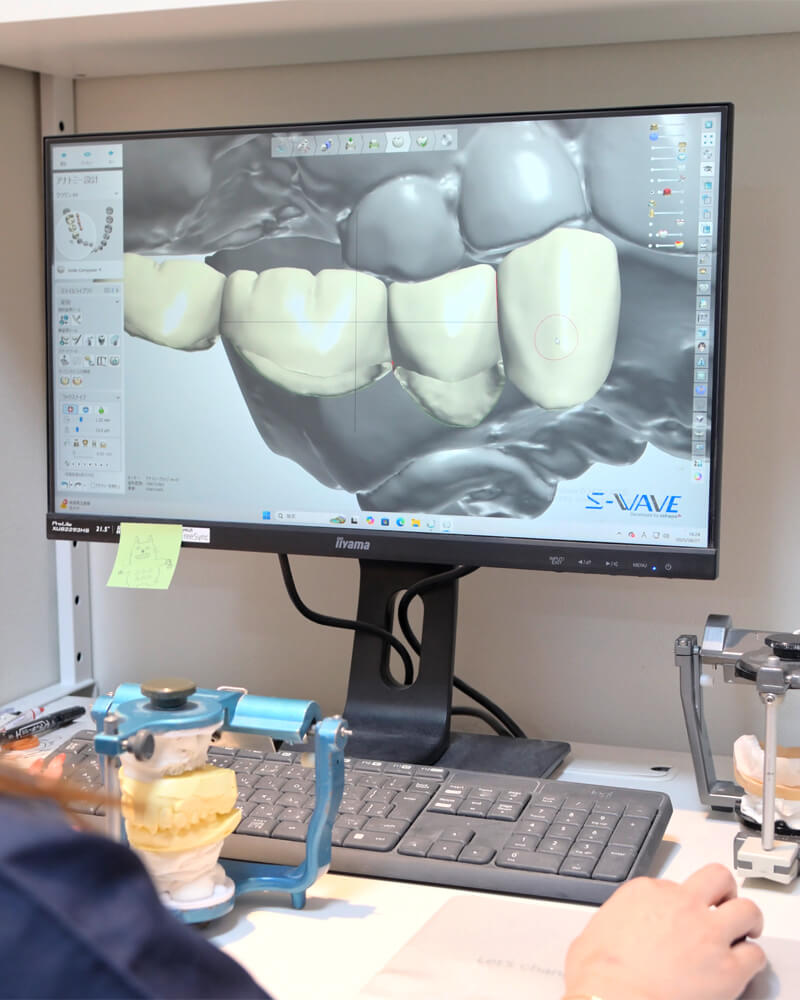 1回の治療に時間をかけ、終了までの期間を短縮!