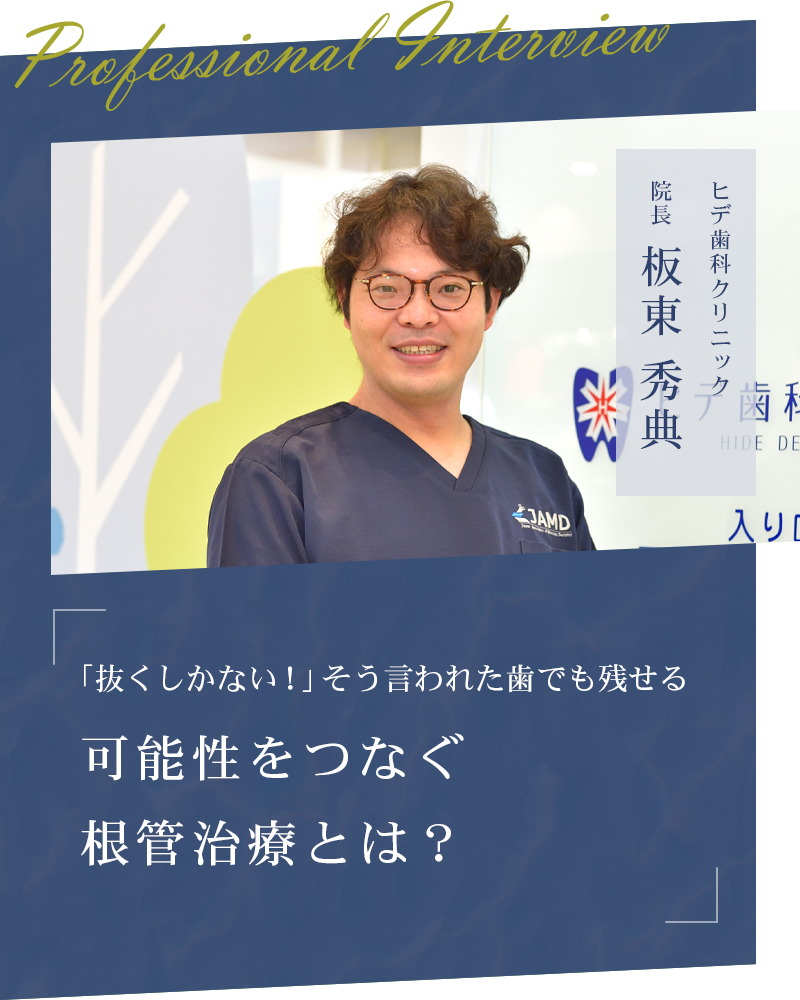 「抜くしかない！」そう言われた歯でも残せる可能性をつなぐ根管治療とは？【大阪市城東区 ヒデ歯科クリニック】