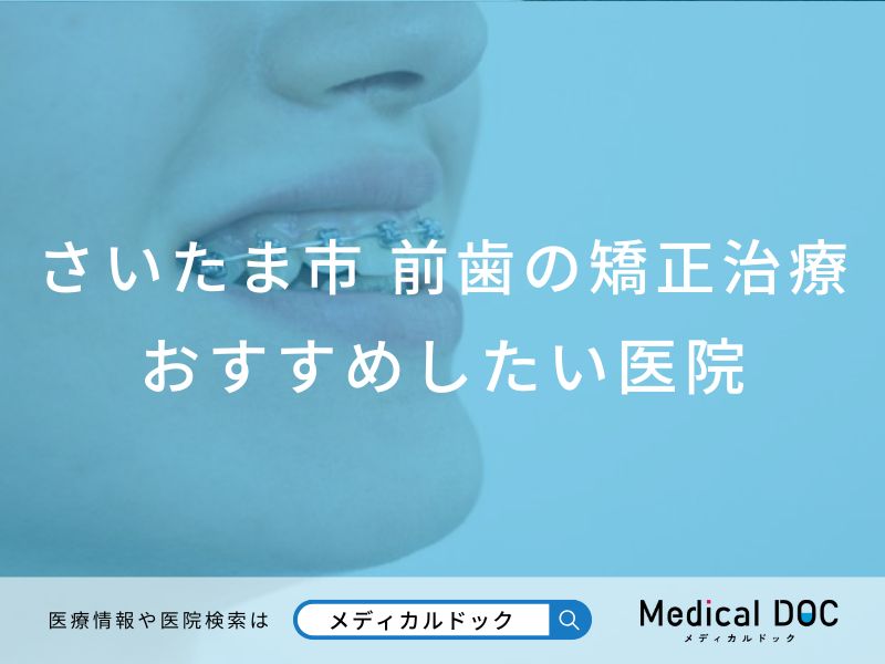 さいたま市 前歯の矯正治療