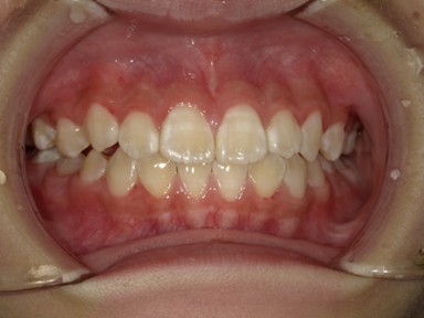 チャイルドしかハウス