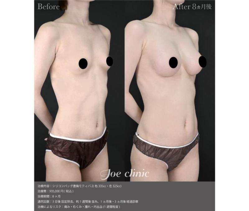 ジョウクリニック銀座院