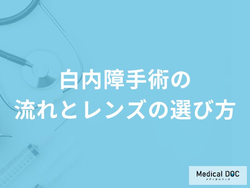 「白内障手術の流れ」はご存知ですか？術後の合併症リスクについても解説！