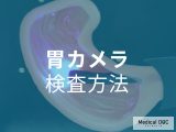 非公開: 正しく理解して不安を解消!「胃カメラ」の検査方法や見つかる症状について【医師解説】