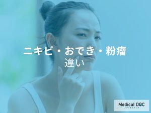 ニキビ・おでき・粉瘤　違い