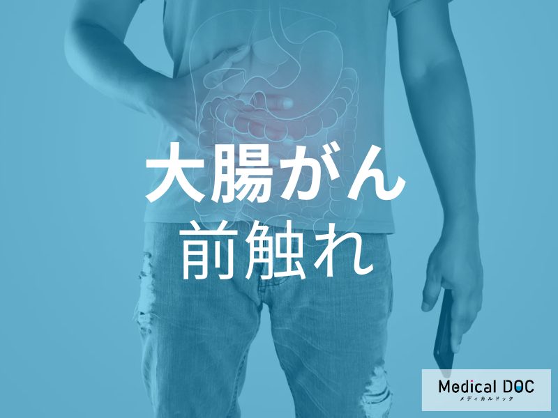 自覚症状なしでも要注意!? 「大腸がん」の前触れとなる前駆病変について【医師が解説】