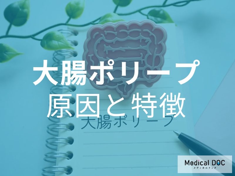 症状がなくても安心できない! 大腸がんの前触れとなる「大腸ポリープ」の原因と特徴【医師が解説】