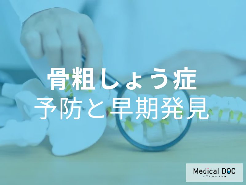 知ってほしい! 骨が脆くなる「骨粗しょう症」治療よりも大事なのは予防と早期発見【医師が解説】