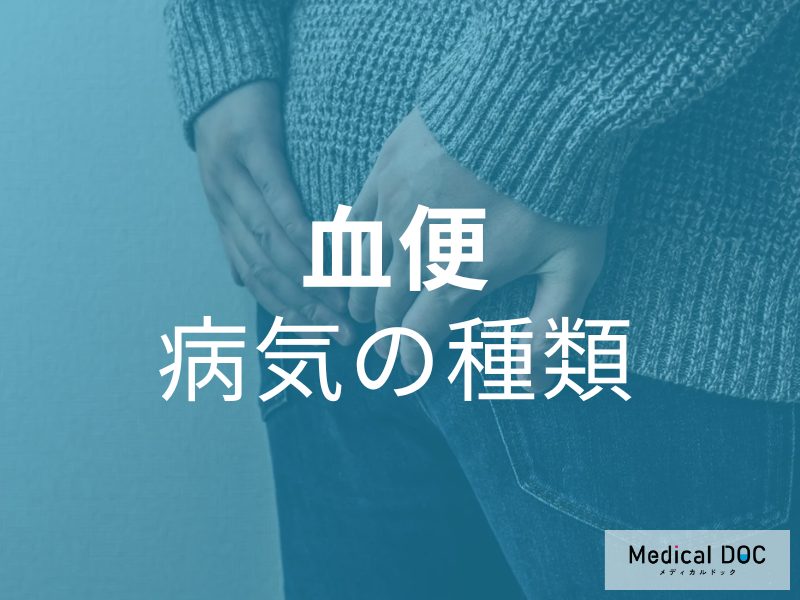 少量の血を見落とさないで! 「血便」の色でわかる考えられる病気の種類とは【医師が解説】