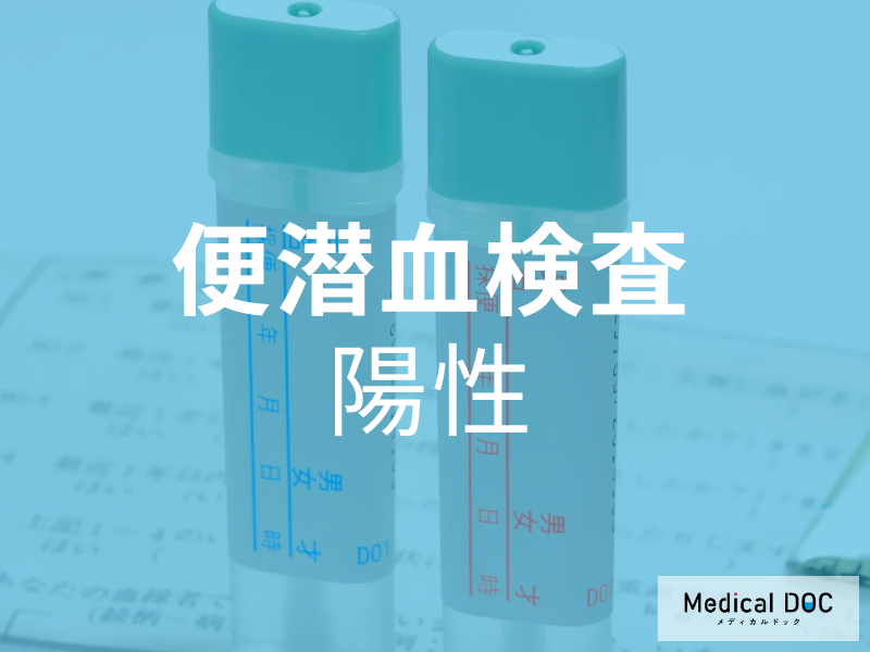 見逃せない“陽性”反応! 「便潜血検査」が示す陽性とはどういうこと? 【医師が解説】