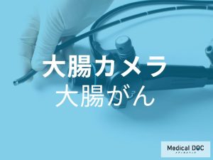 大腸カメラ　大腸がん