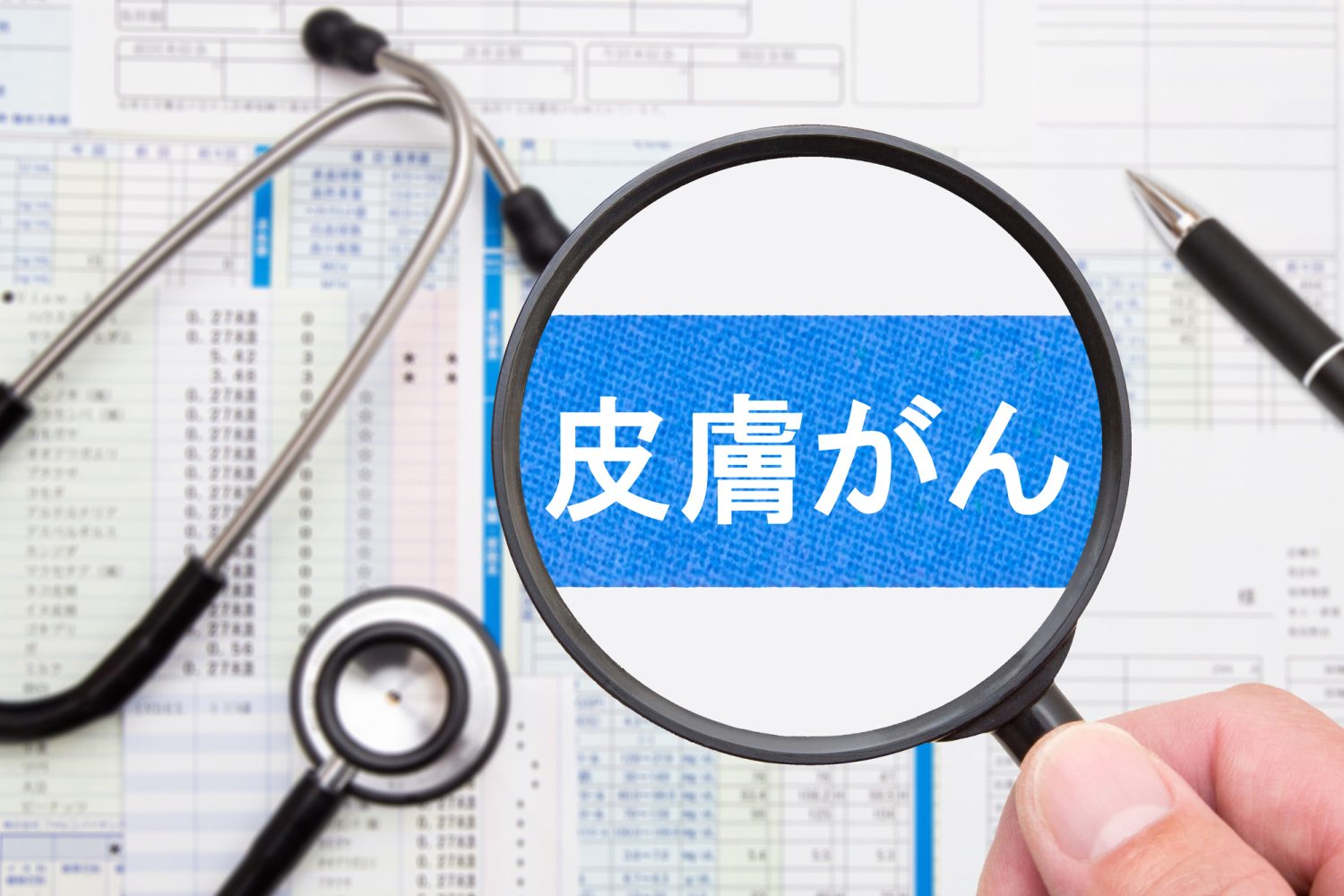 やけどの傷跡が皮膚がんを引き起こすってホント?