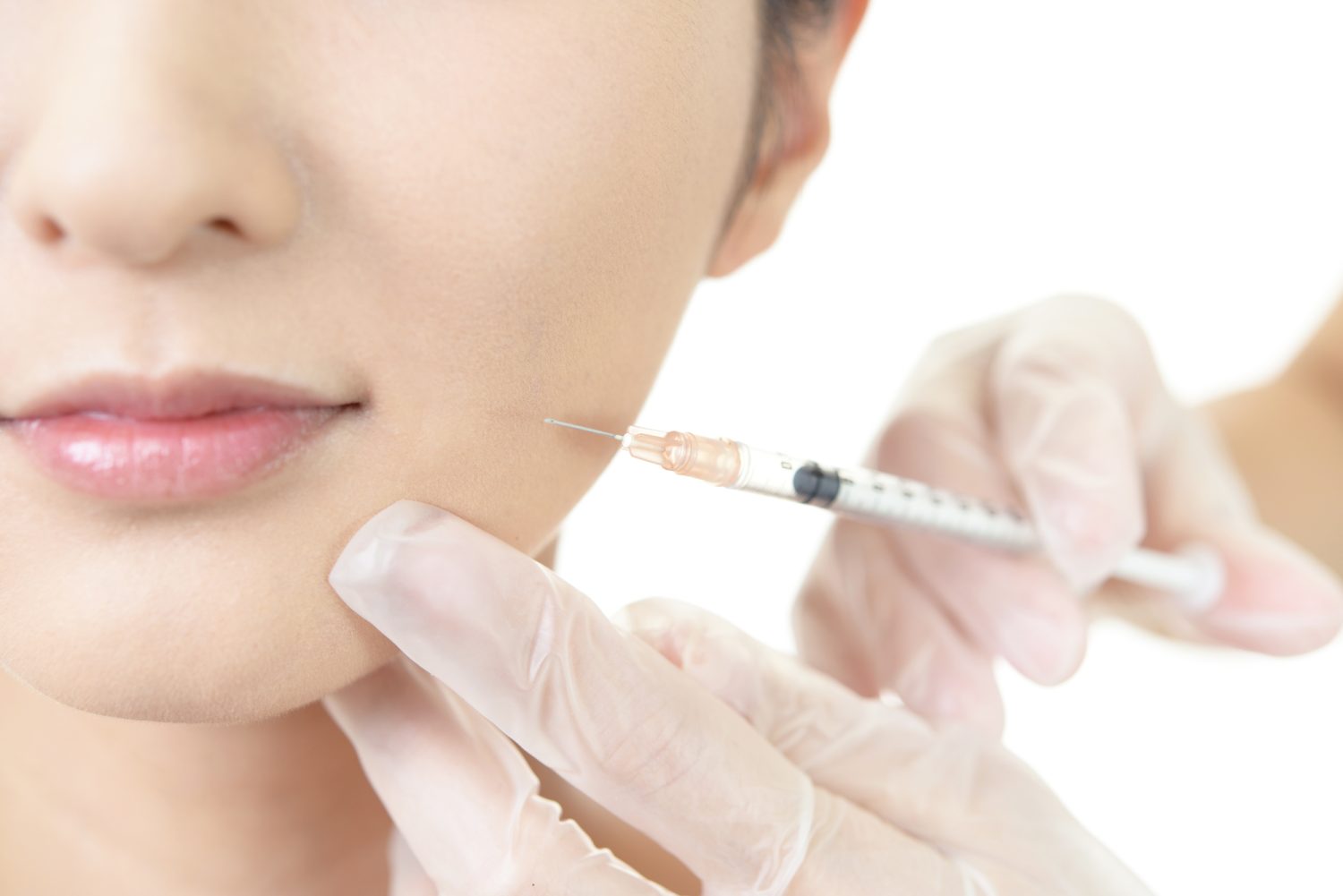 ヒアルロン酸注入によるしわ治療の注意点やリスク