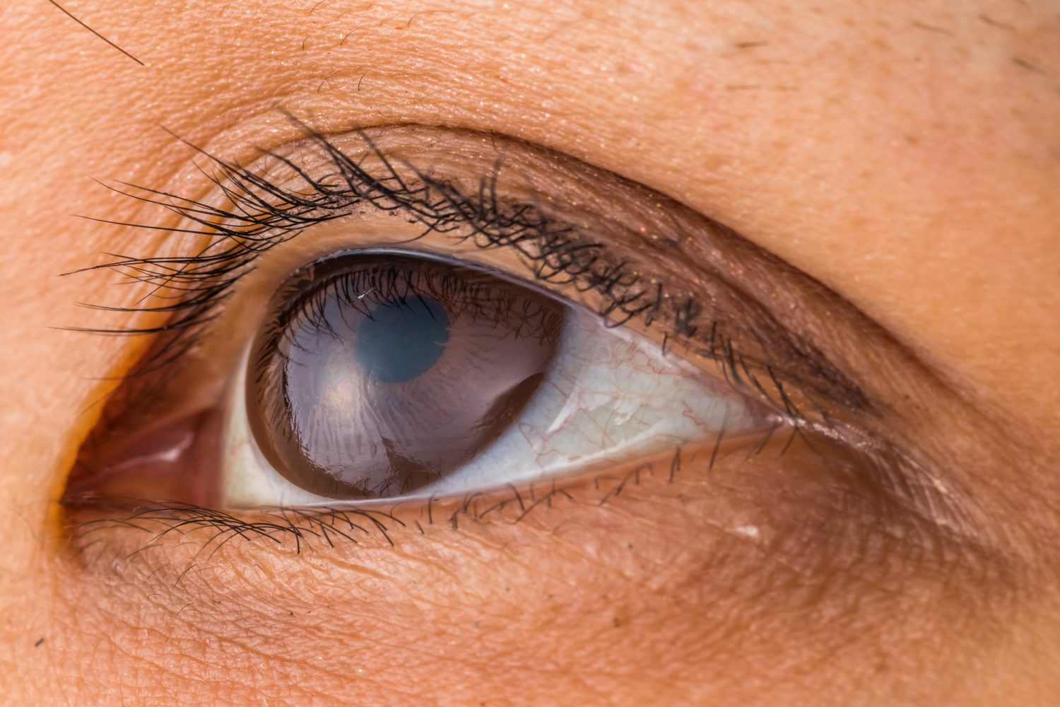 多焦点眼内レンズの仕組み