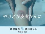 “やけどの跡”が「皮膚がん」になるのをご存じですか？ 初期症状を医師が解説