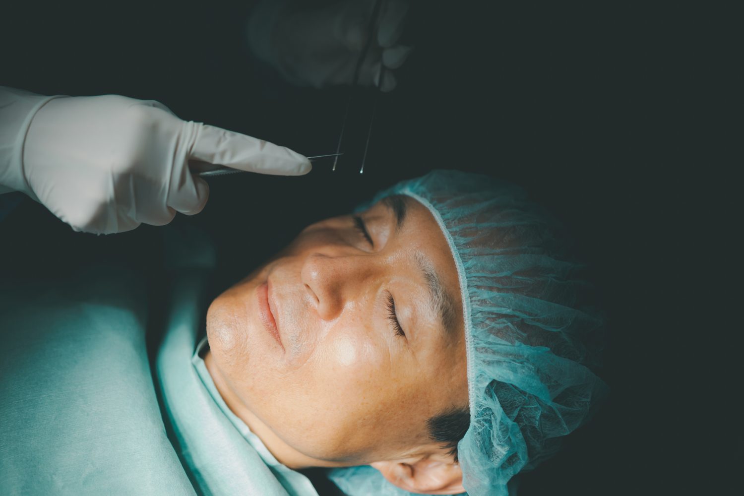 トラベクロトミーとは