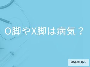 O脚やX脚は病気？