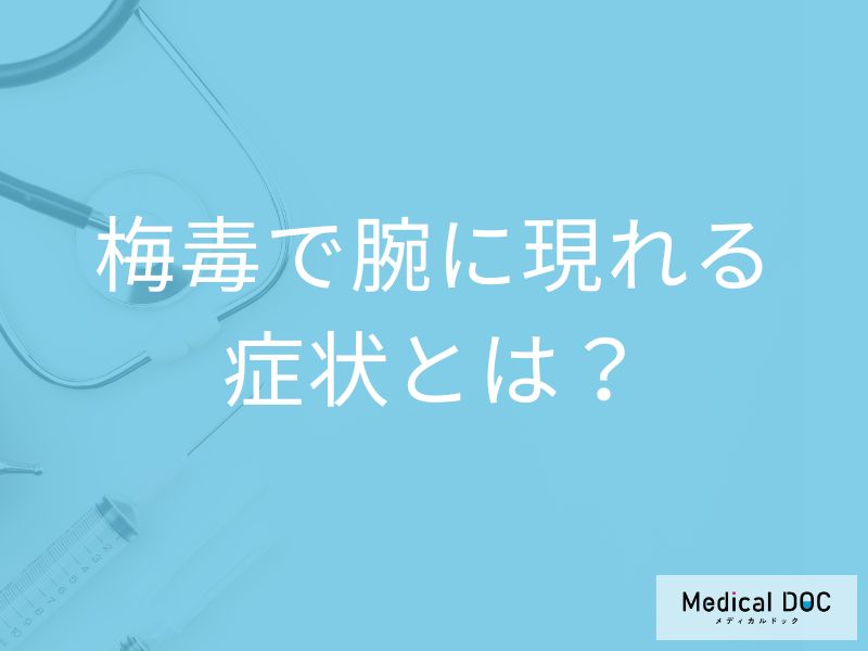 「梅毒」を発症すると「腕」にどんな症状が現れるかご存知ですか？【医師監修】